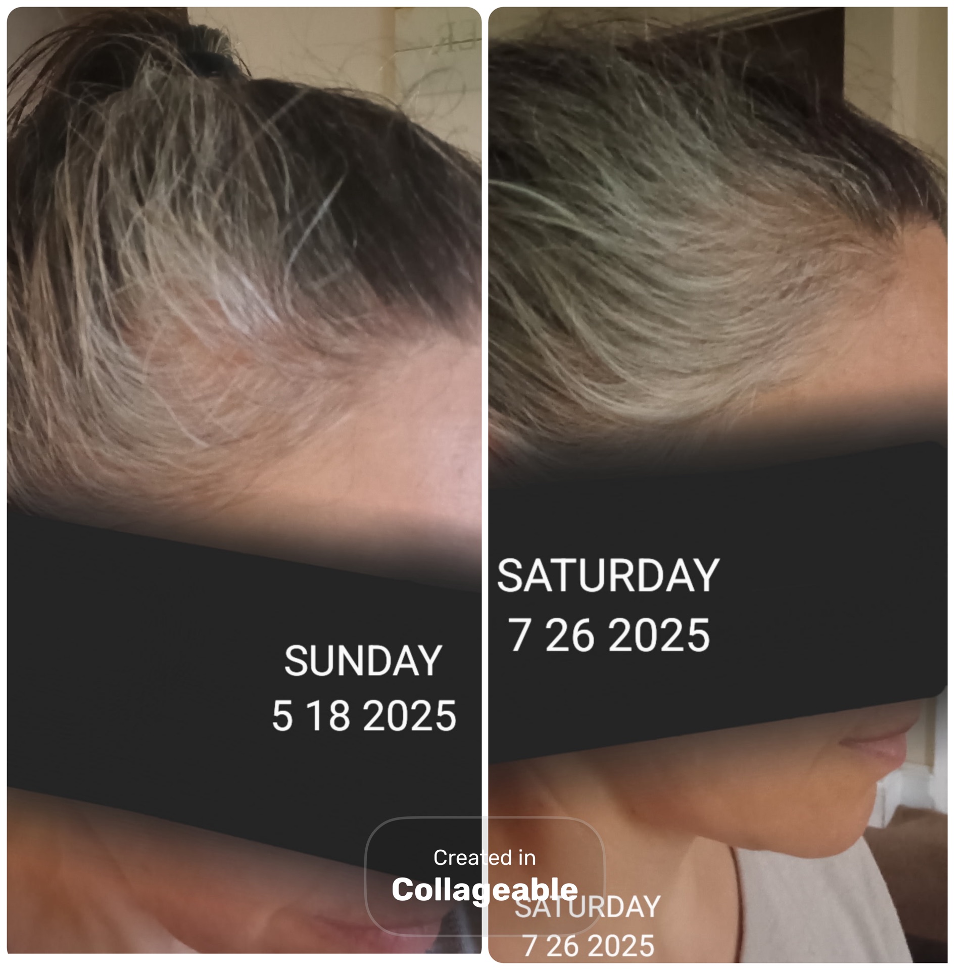 Brown Suga Barr Hair Growth Serum - Image 7